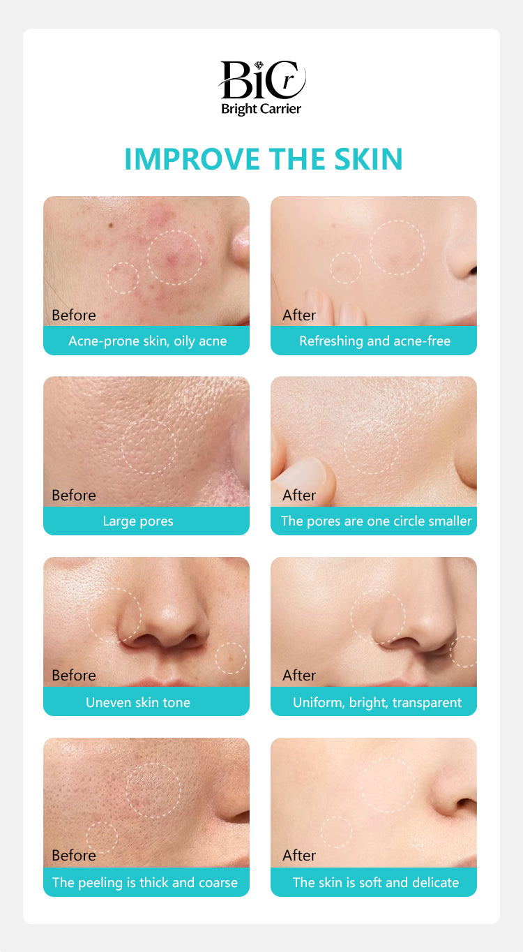 Hyaluronic Acid Skin Booster