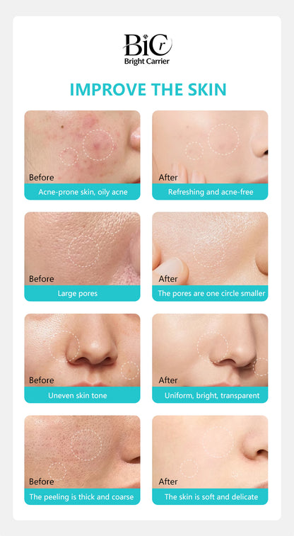 Hyaluronic Acid Skin Booster